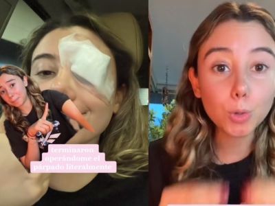 ¡Terminó mal! Joven fue operada del párpado por seguir hack de belleza de TikTok